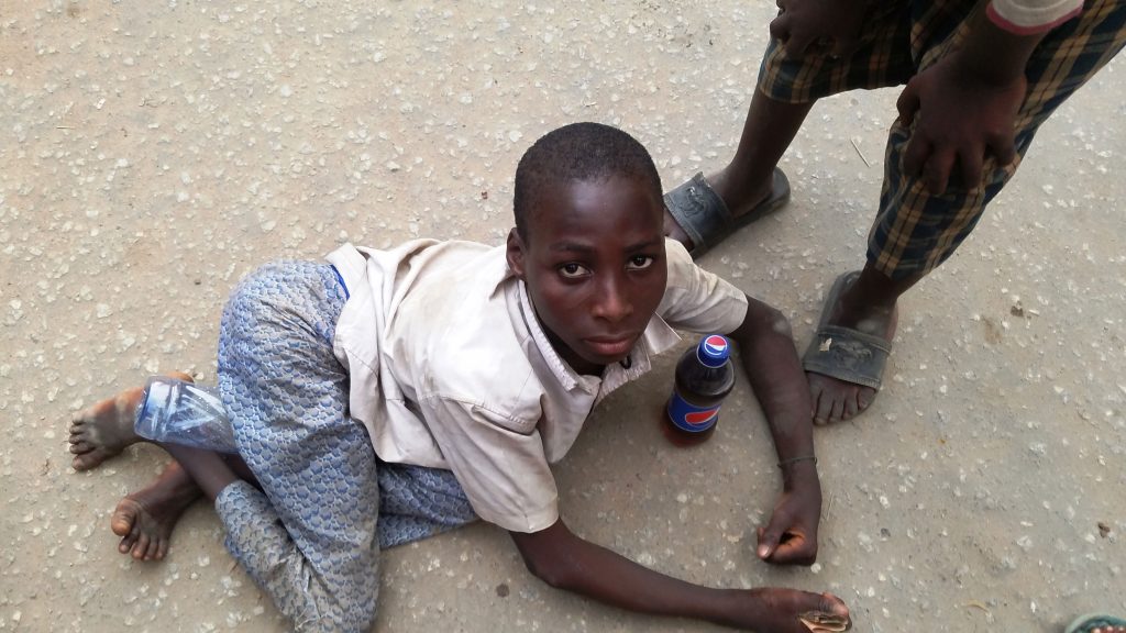 A young polio survivor at the Computer Village, Ikeja, Nigeria             